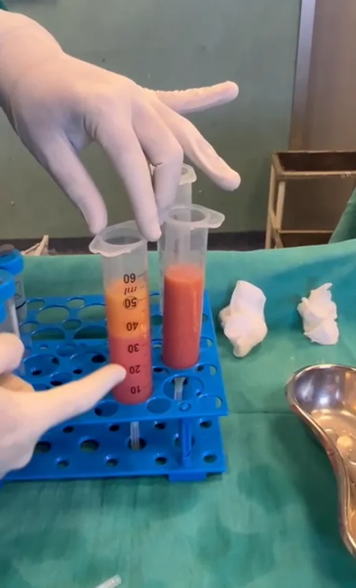 Autologous tissue preparation